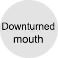 Downturned mouth